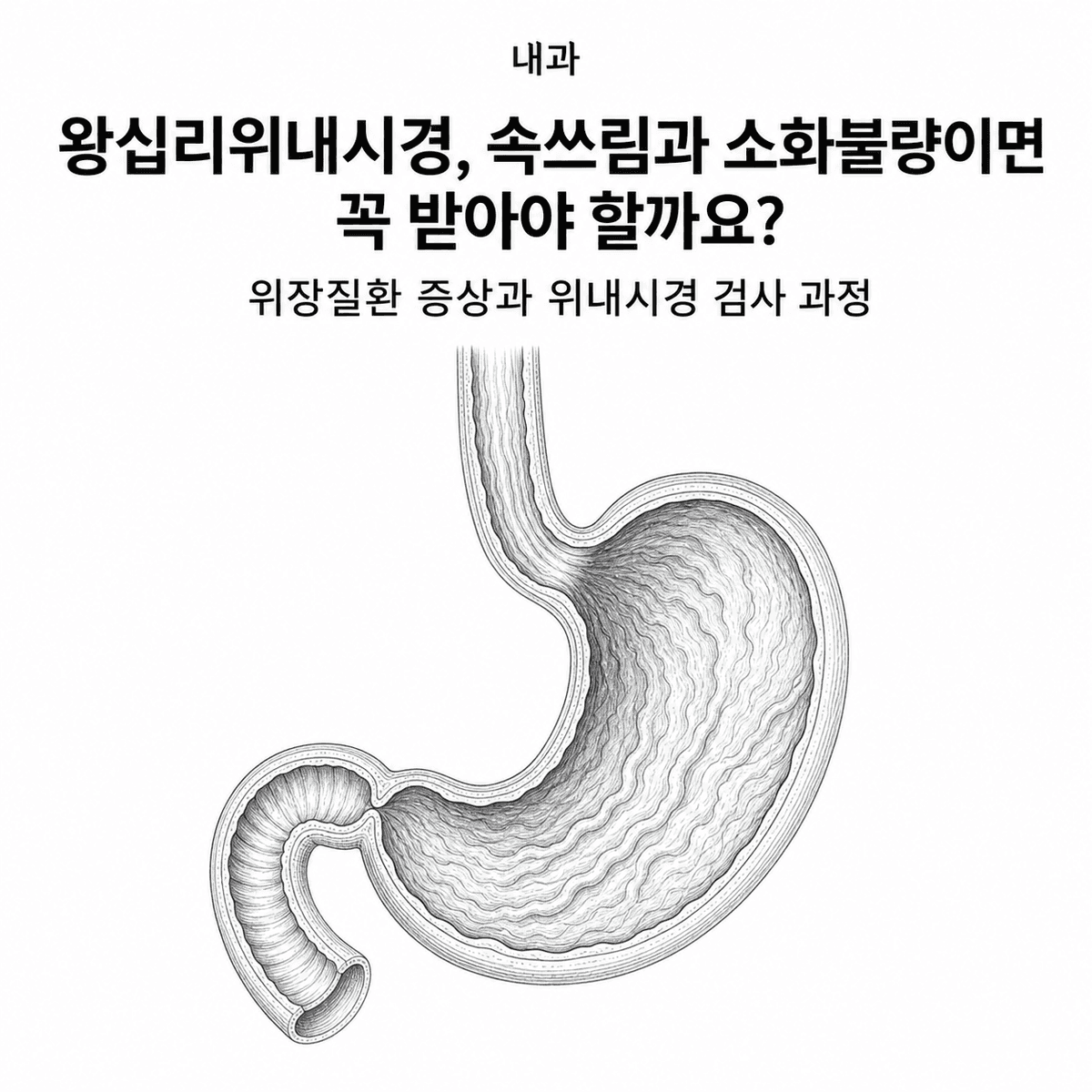 서울 내과 왕십리위내시경, 위장질환 증상과 검사 과정은 어떻게 확인할까요 핵심 정보 이미지